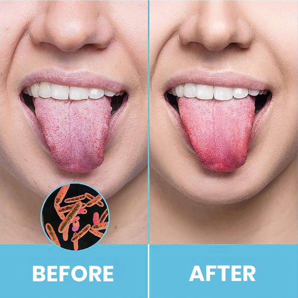 Dentix™ Stainless Steel Tongue Cleaner